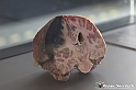 VBS_3017 - Infarto cerebrale - Mostra Body Worlds